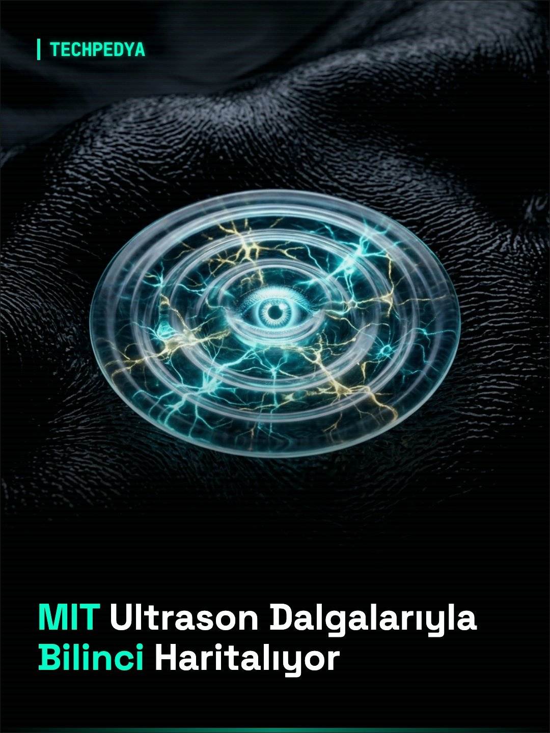 MIT Ultrason Dalgalarıyla Bilinci Haritalıyor