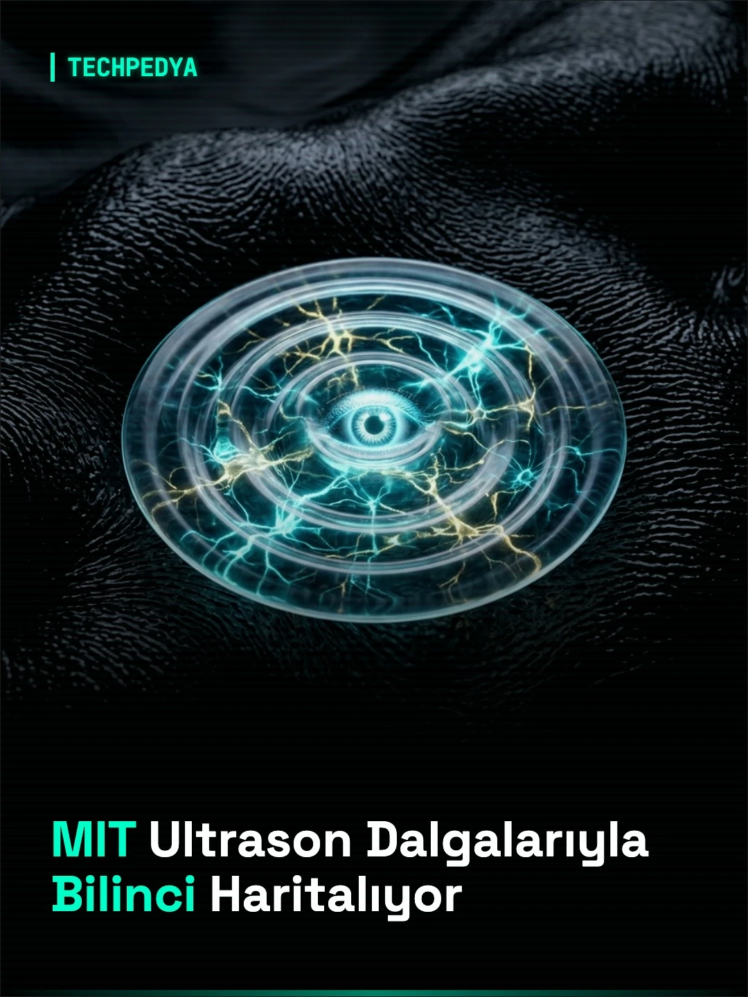 MIT Ultrason Dalgalarıyla Bilinci Haritalıyor