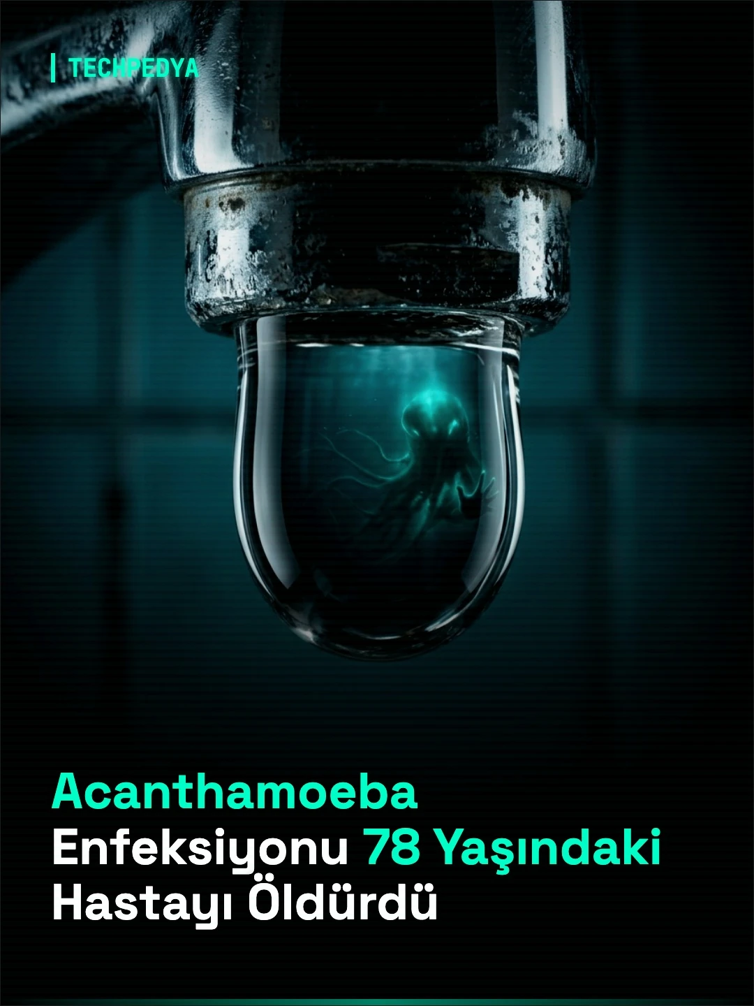 Acanthamoeba Enfeksiyonu 78 Yaşındaki Hastayı Öldürdü