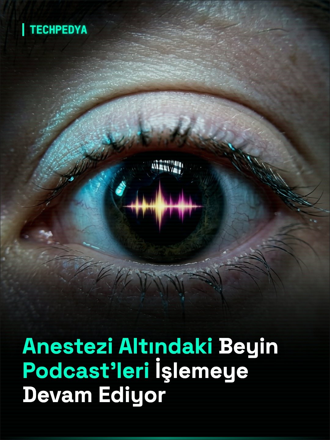 Anestezi Altındaki Beyin Podcast'leri İşlemeye Devam Ediyor