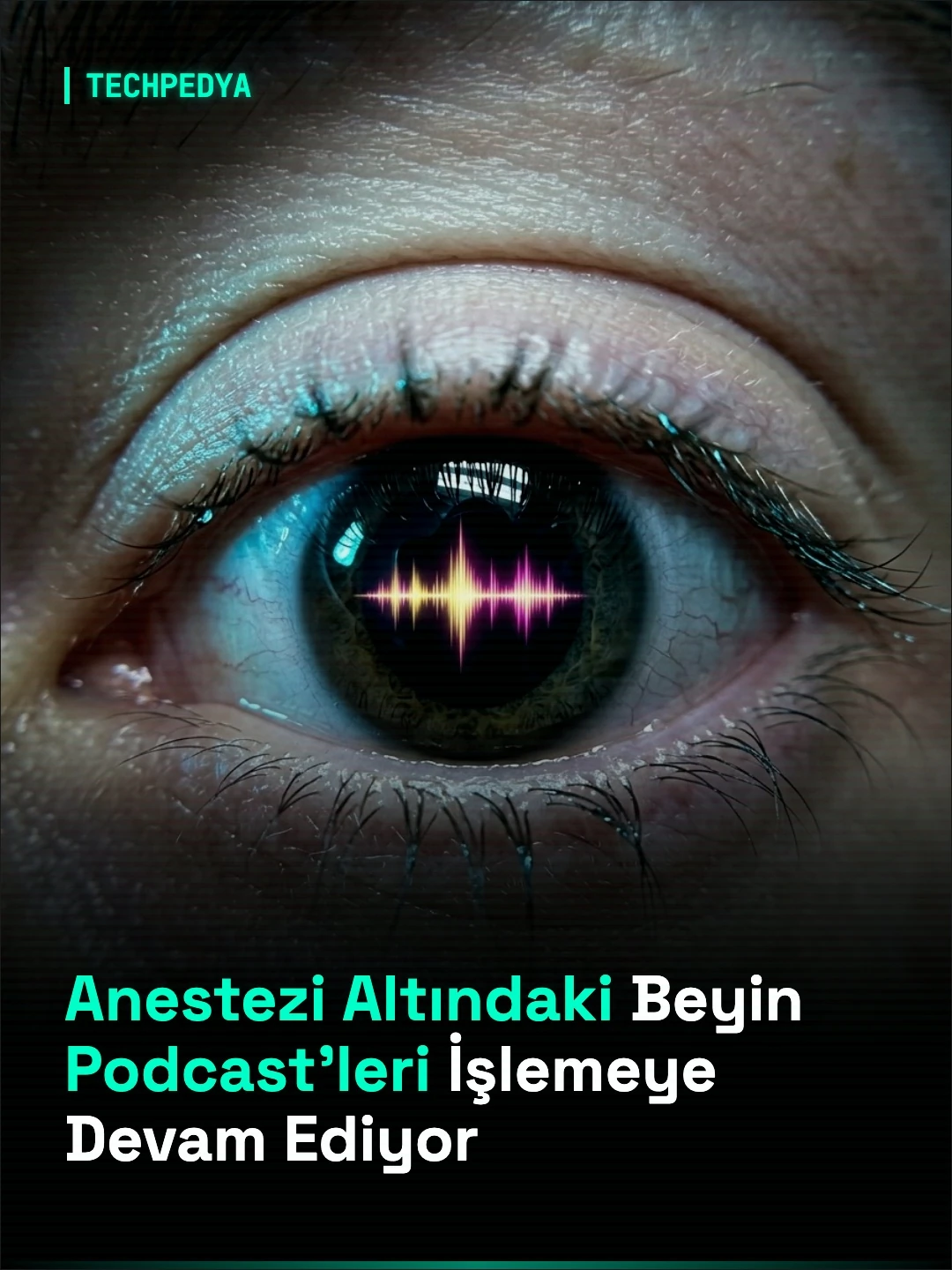 Anestezi Altındaki Beyin Podcast'leri İşlemeye Devam Ediyor