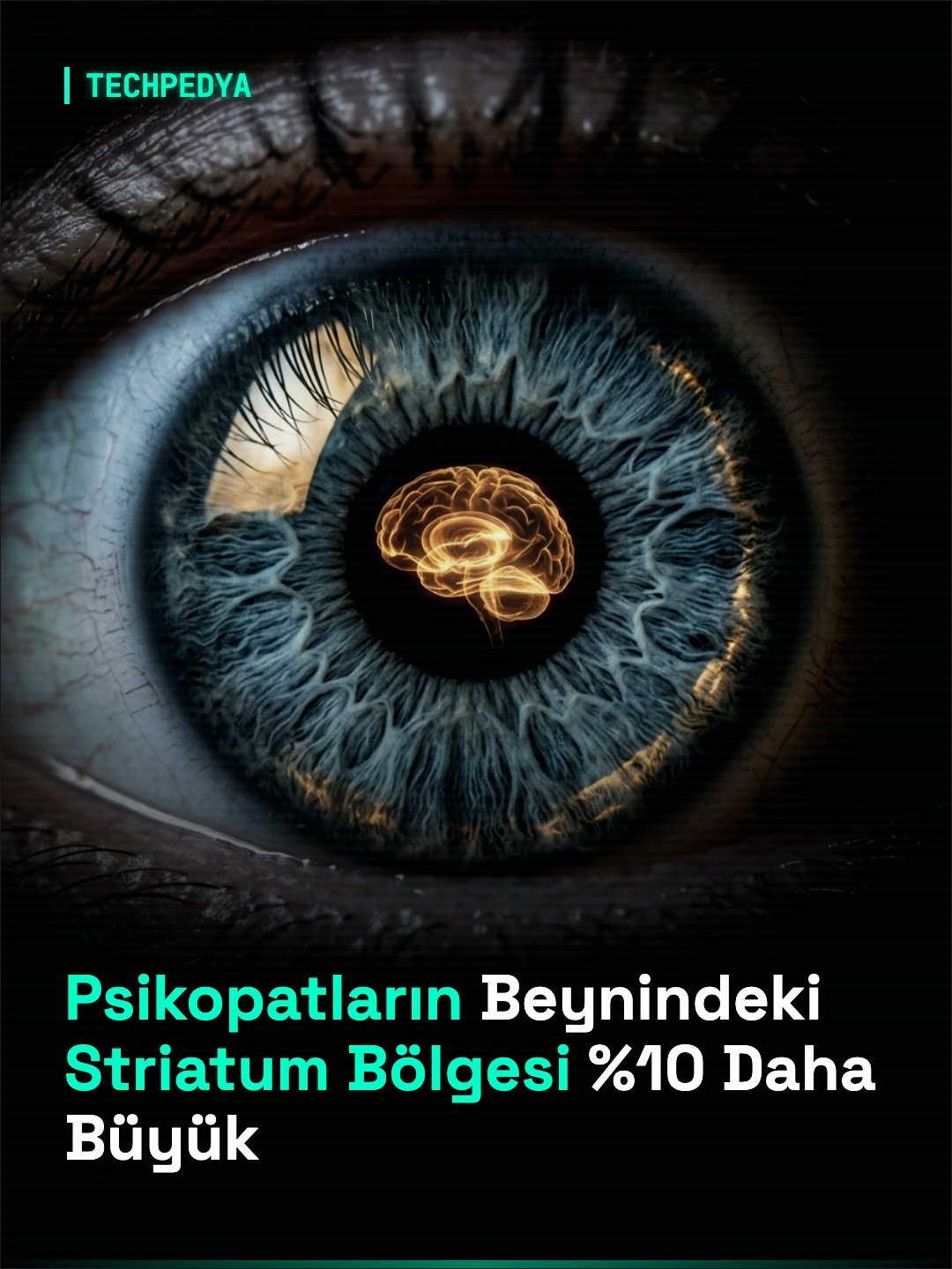 Psikopatların Beynindeki Striatum Bölgesi %10 Daha Büyük