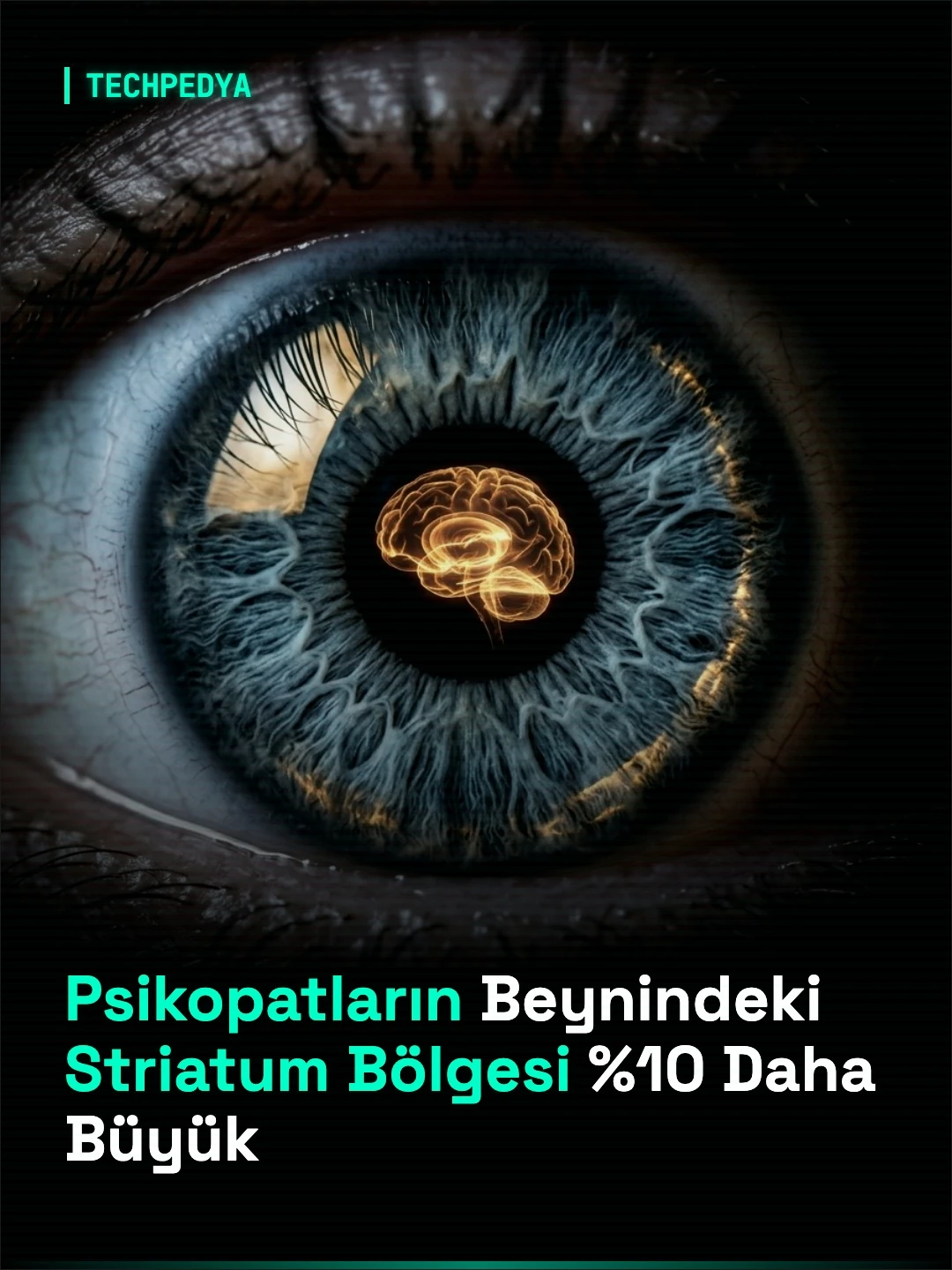 Psikopatların Beynindeki Striatum Bölgesi %10 Daha Büyük