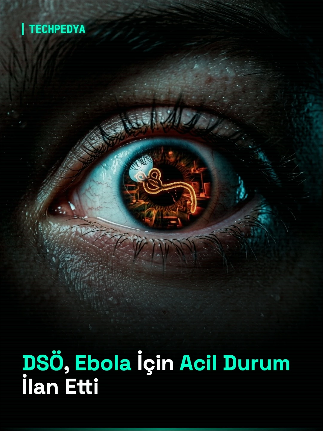 DSÖ, Ebola İçin Acil Durum İlan Etti