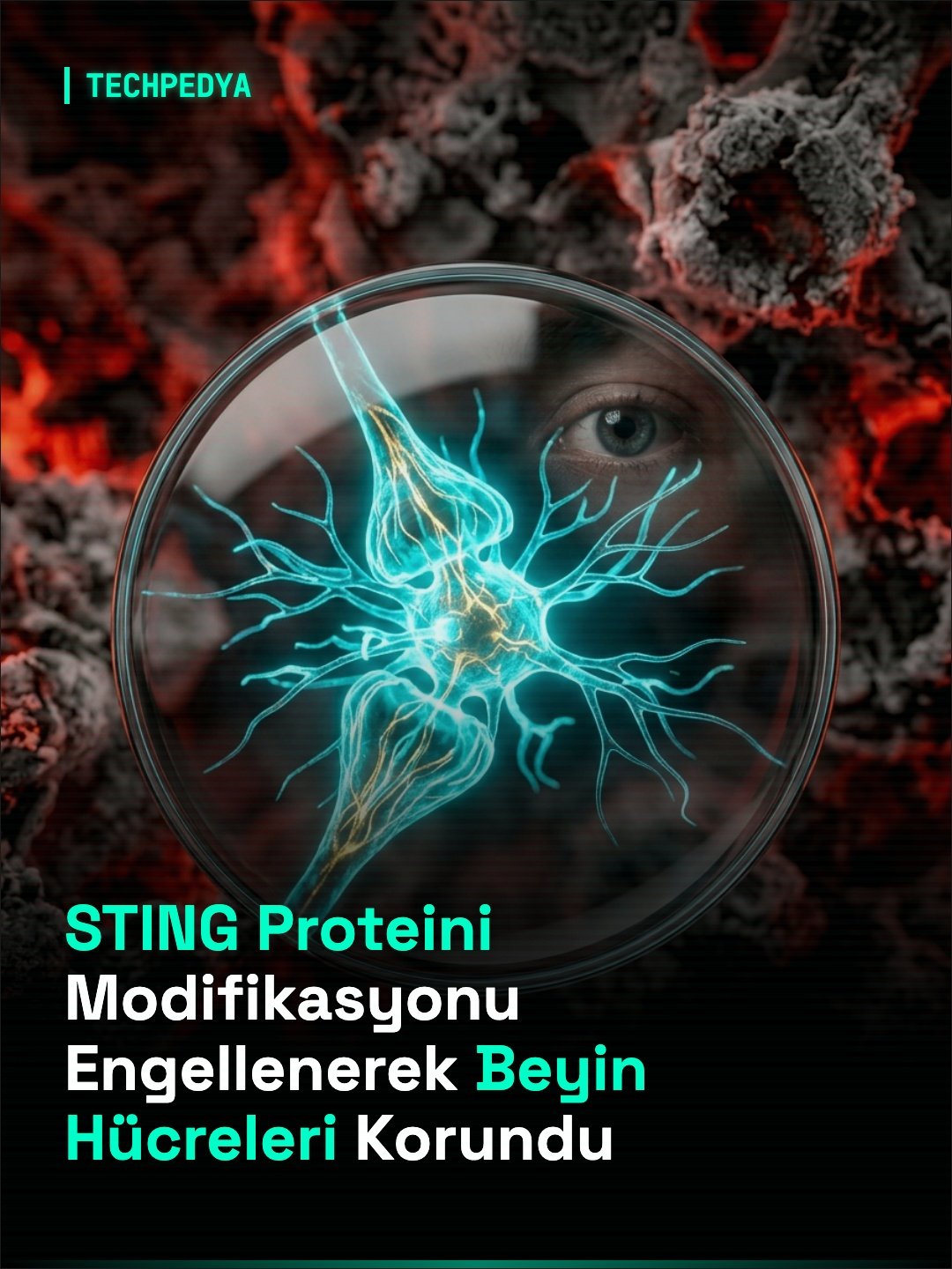 STING Proteini Modifikasyonu Engellenerek Beyin Hücreleri Korundu