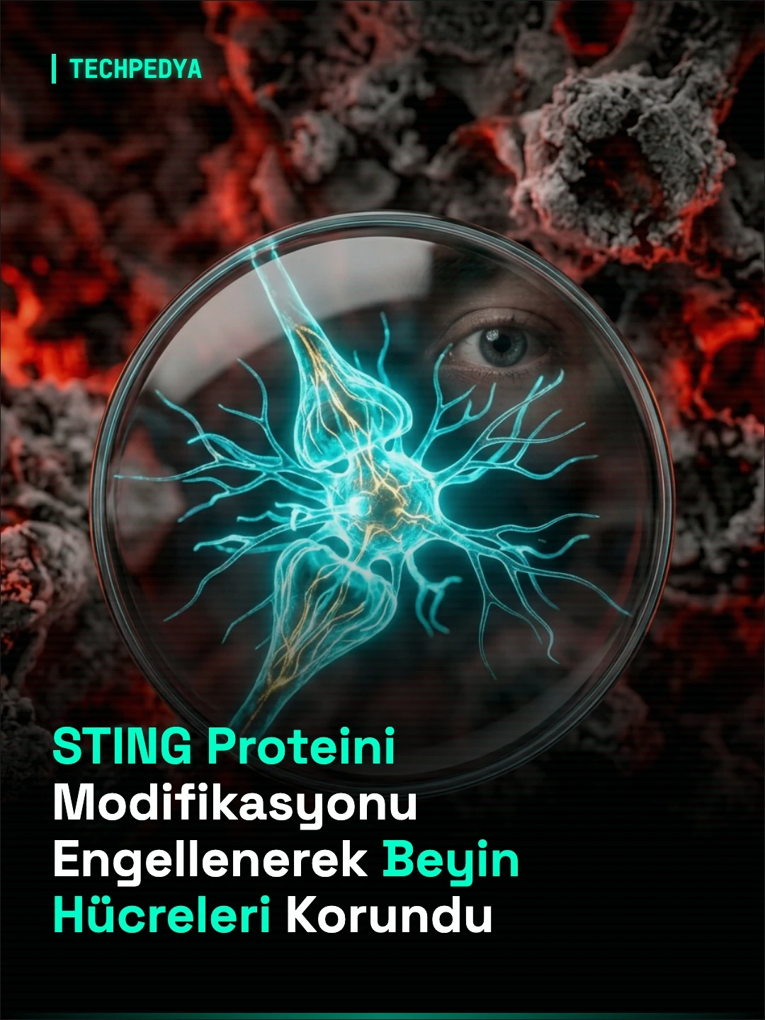 STING Proteini Modifikasyonu Engellenerek Beyin Hücreleri Korundu