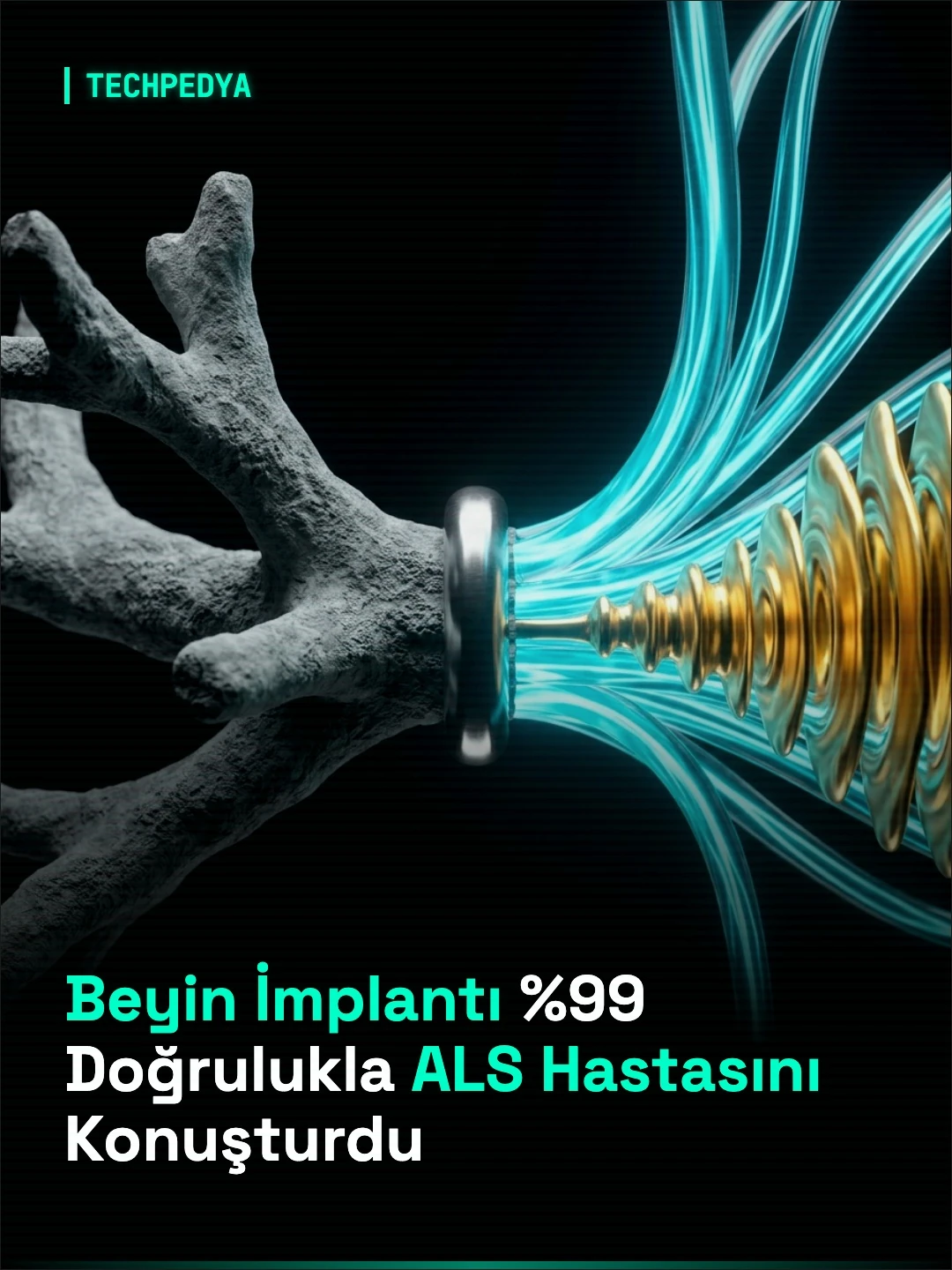 Beyin İmplantı %99 Doğrulukla ALS Hastasını Konuşturdu