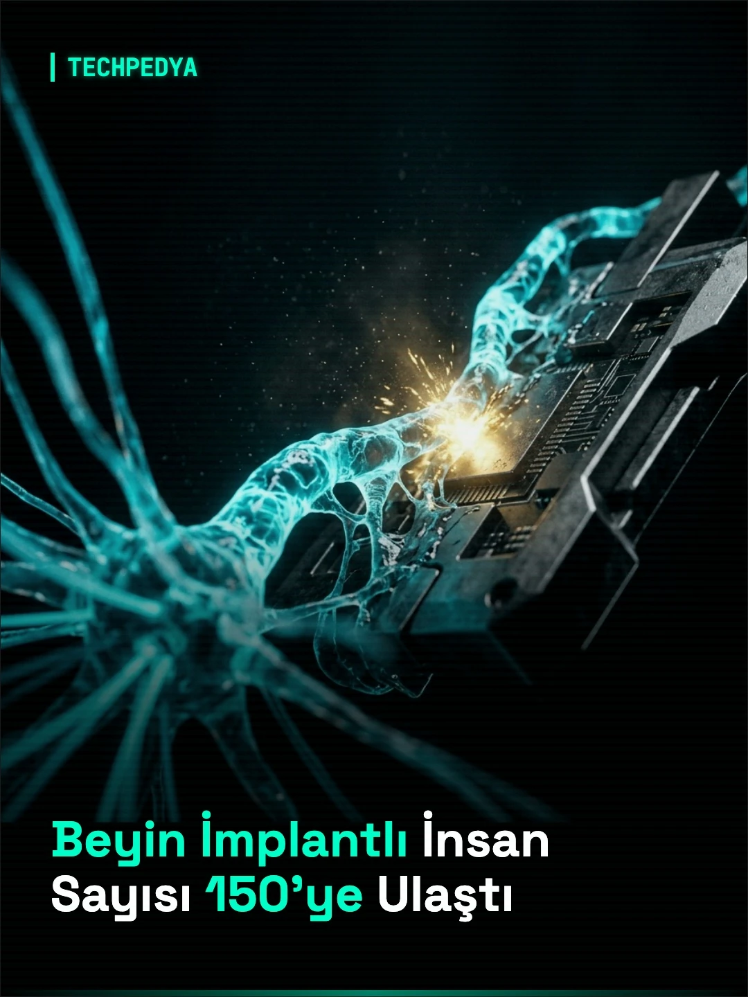 Beyin İmplantlı İnsan Sayısı 150'ye Ulaştı