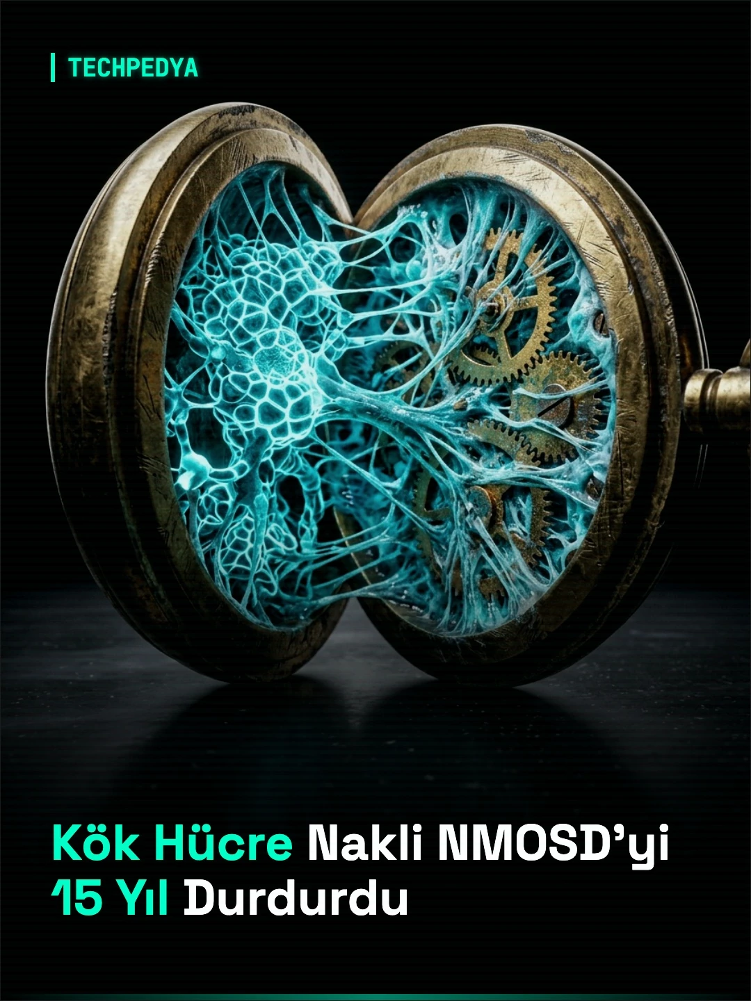 Kök Hücre Nakli NMOSD'yi 15 Yıl Durdurdu