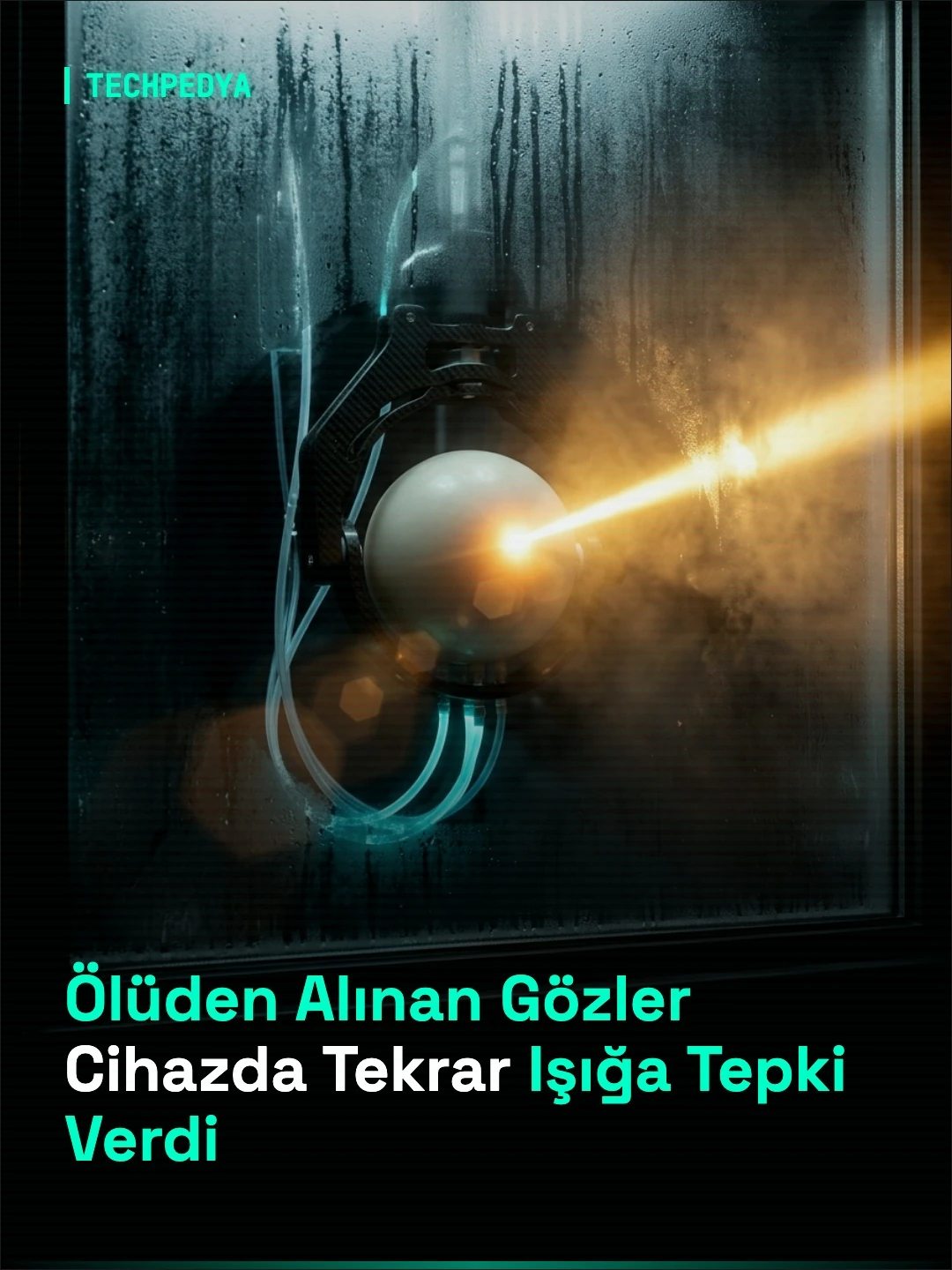 Ölüden Alınan Gözler Cihazda Tekrar Işığa Tepki Verdi