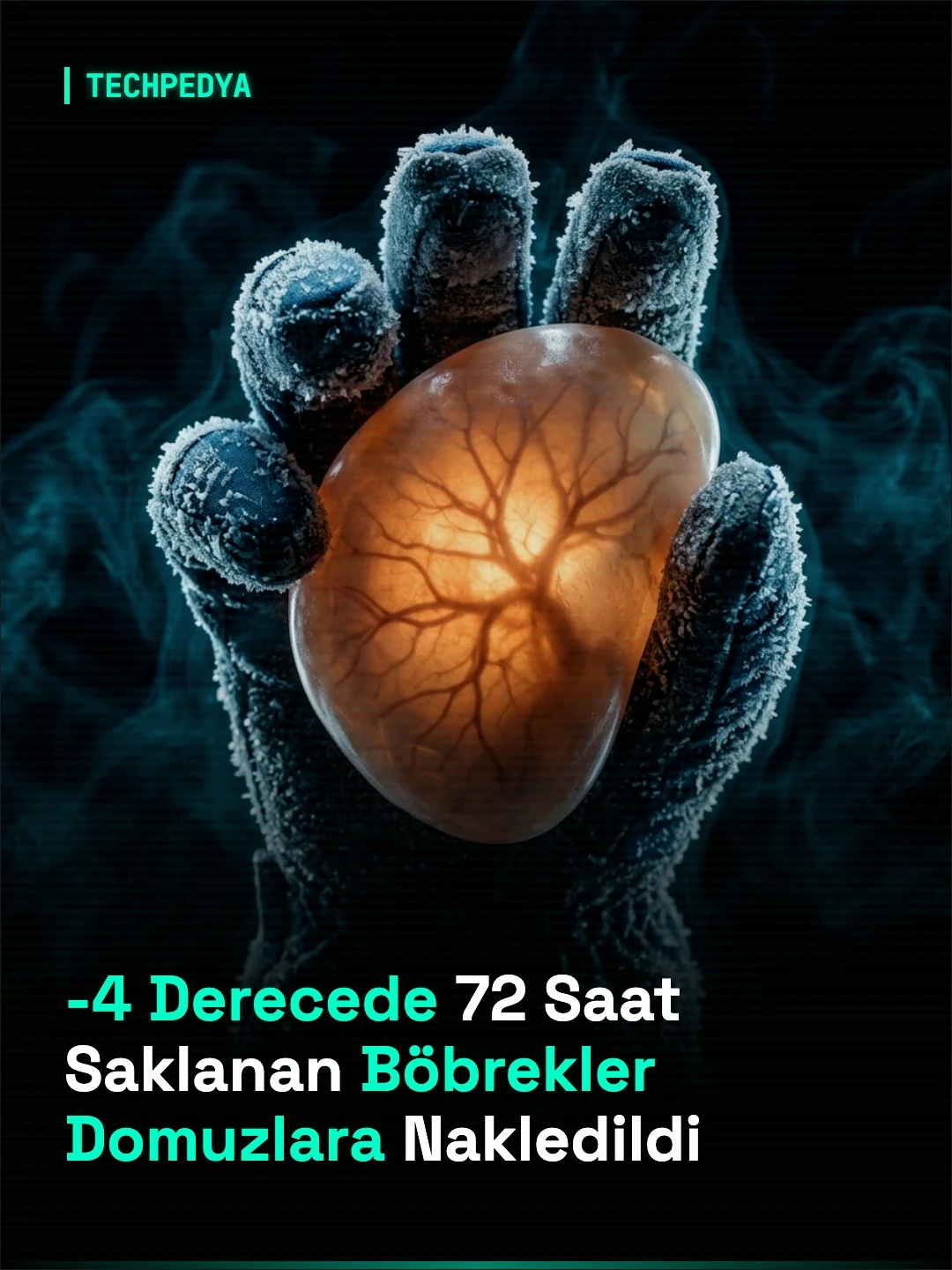 -4 Derecede 72 Saat Saklanan Böbrekler Domuzlara Nakledildi