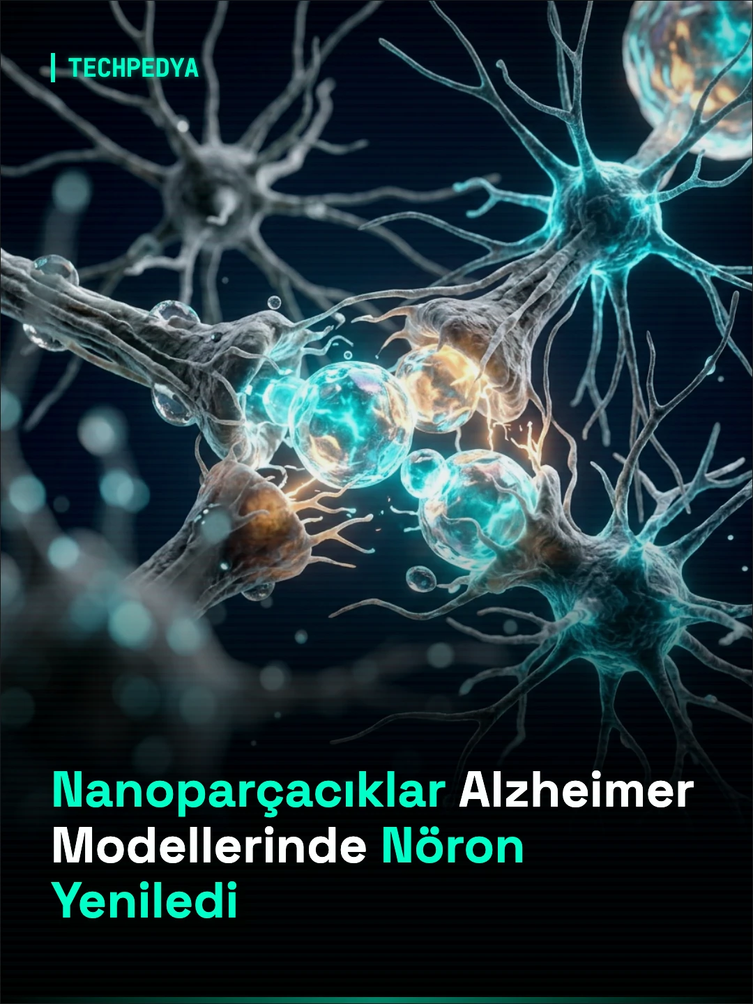 Nanoparçacıklar Alzheimer Modellerinde Nöron Yeniledi