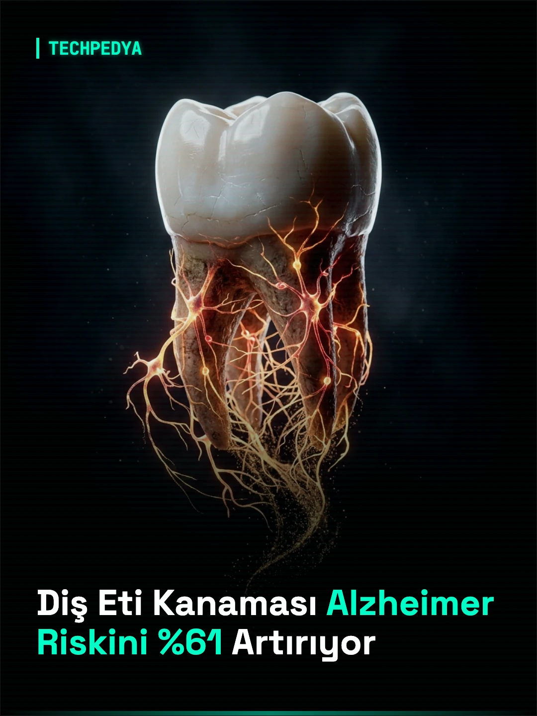 Diş Eti Kanaması Alzheimer Riskini %61 Artırıyor