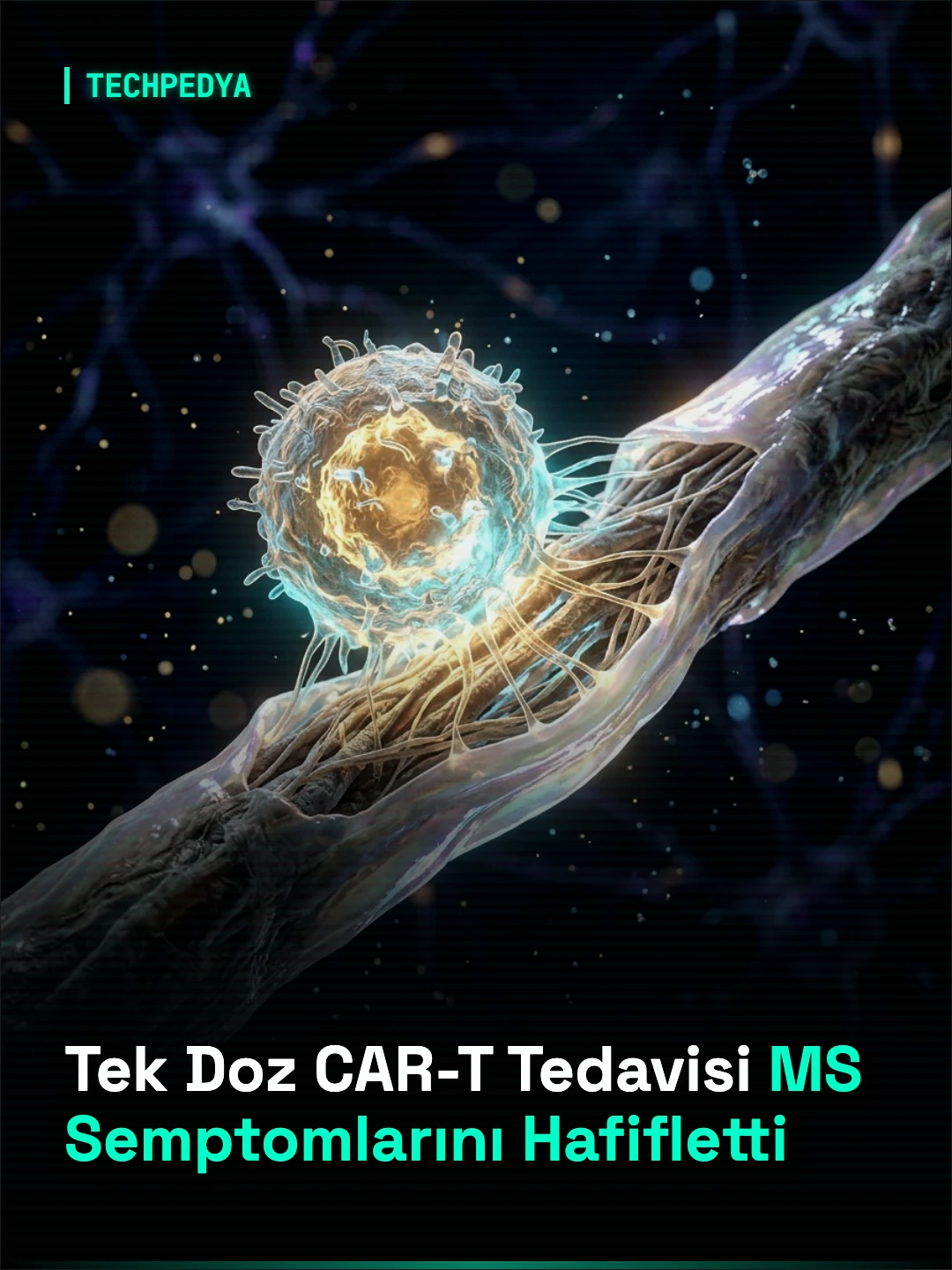 Tek Doz CAR-T Tedavisi MS Semptomlarını Hafifletti